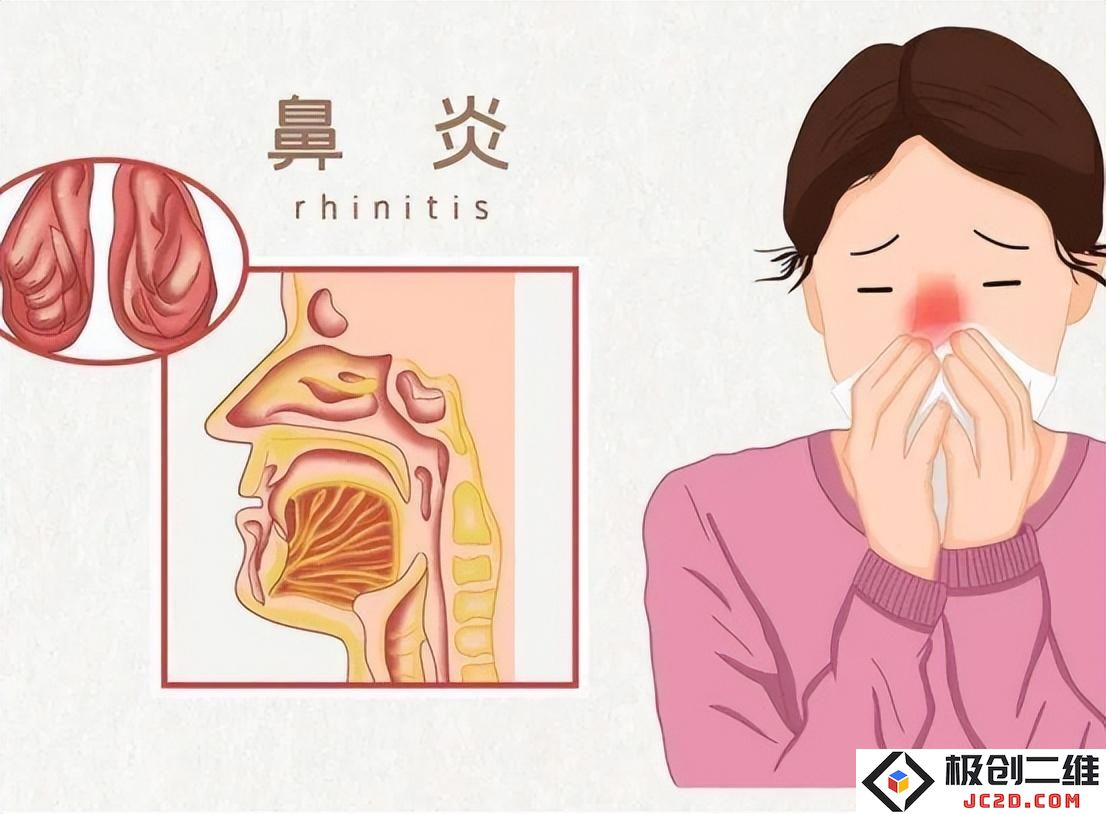 变应性鼻炎难根治，现代医学治疗变应性鼻炎患者有哪些疗法？