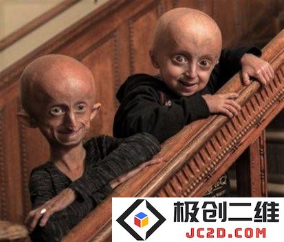 吴花燕被诊断为极为罕见的早老症，若能早期治疗是否有望恢复健康？